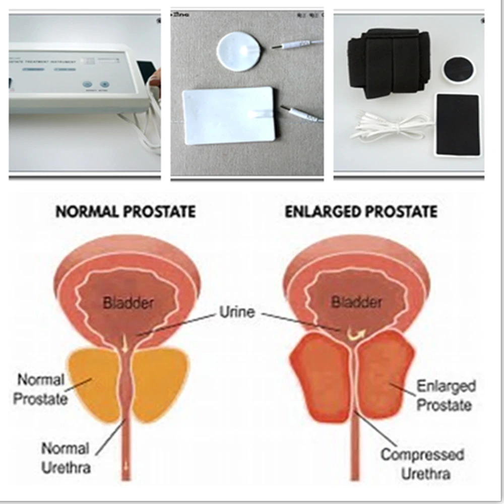 Güçlü Prostat Masaj Aleti Erke - Therapy Health And Wellness incelemesi ve fiyatı